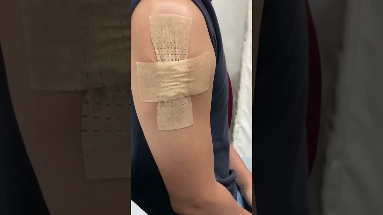 Pressuer Band (PB) cross banding for higher pressure