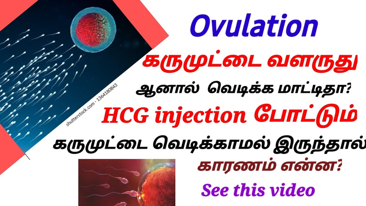 Ovulation Injection Ovulation//கருமுட்டை//Hcg injection போட்டும் கருமுட்டை வெடிக்காமல் ...