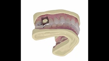 3D Printed Analog Model