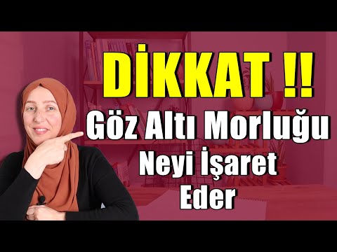 DİQQƏT - Göz Altı Çürüklər Nədir, Fzt Aynur BAŞ