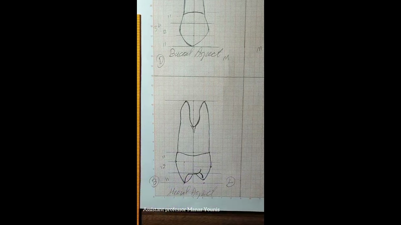 рисунок постоянного первого премоляра верхней челюсти