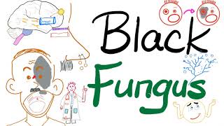 Mucor & Rhizopus - Black Fungus and COVID-19