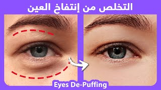 3 mins How to naturally get rid of puffiness around the eyes