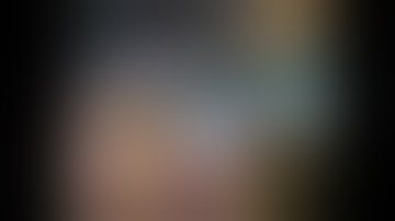 Laparoscopic Left Nephroureterectomy