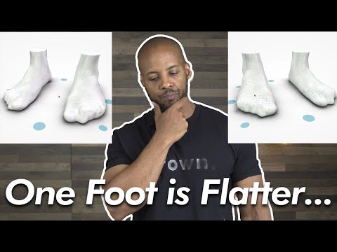 Wideo: Czy jedna stopa może być bardziej płaska od drugiej?