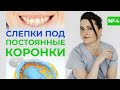 Протезирование зубов / Как делаются слепки зубов под постоянные коронки?
