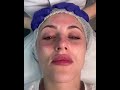 Безинъекционная мезотерапия _4- я часть #косметология #курсыкосметологов #эстетическаякосметология