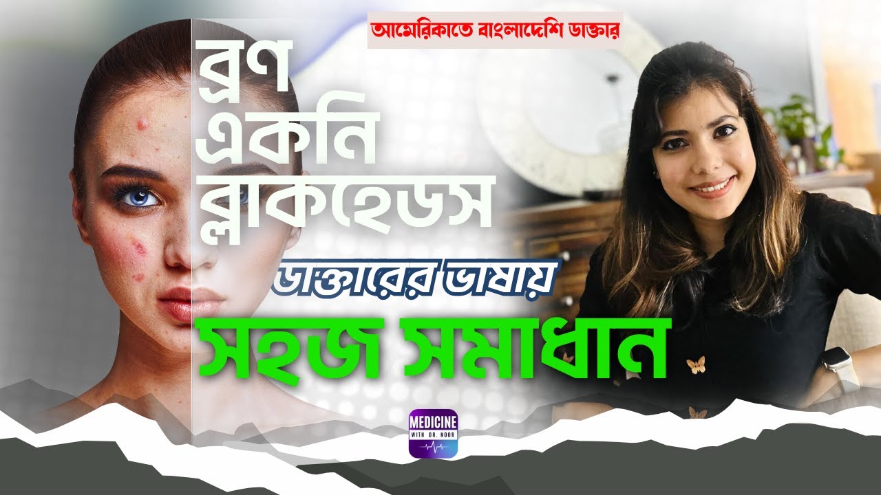ব্রণ সমস্যা ও ডাক্তারের ভাষায় সহজ সমাধান ।। Acne Problem and Solutions