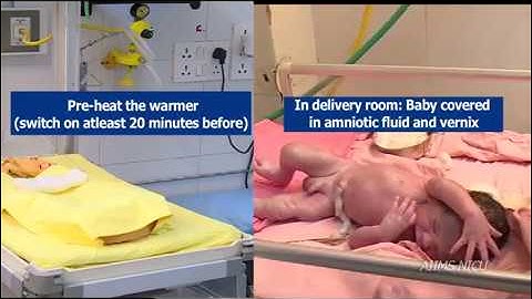 How to use a Radiant Warmer?