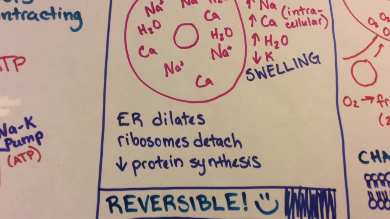 Ischemic Reperfusion Injury