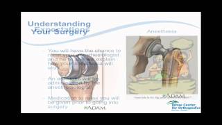 Barton's Total Joint Replacement Power Point Presentation