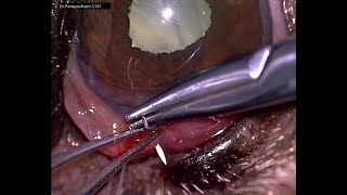 Сквозная травма роговицы у йоркширского терьера / Penetration corneal injury in Yorkshire terrier