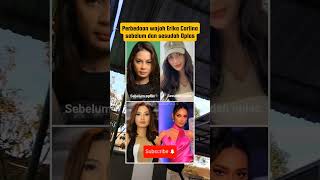 Perbedaan wajah Erika Carlina sebelum dan sesudah Oplas#erikacarlina #oplas #artisindonesia