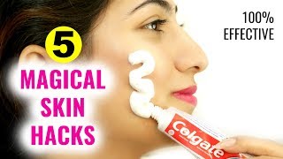 5 Magical Beauty HACKS Using TOOTHPASTE - Pimples, Dark Spots, Pink Lips | Anaysa