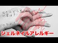 【ジェルネイルアレルギー】ネイリストを悩ませる！出たらどうする？対策は？　 クマ先生のネイルTV #145
