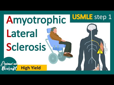ვიდეო: როგორ დავადგინოთ ALS (ამიოტროფიული გვერდითი სკლეროზი): 15 ნაბიჯი