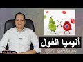 أنيميا الفول G6PD Deficiency 