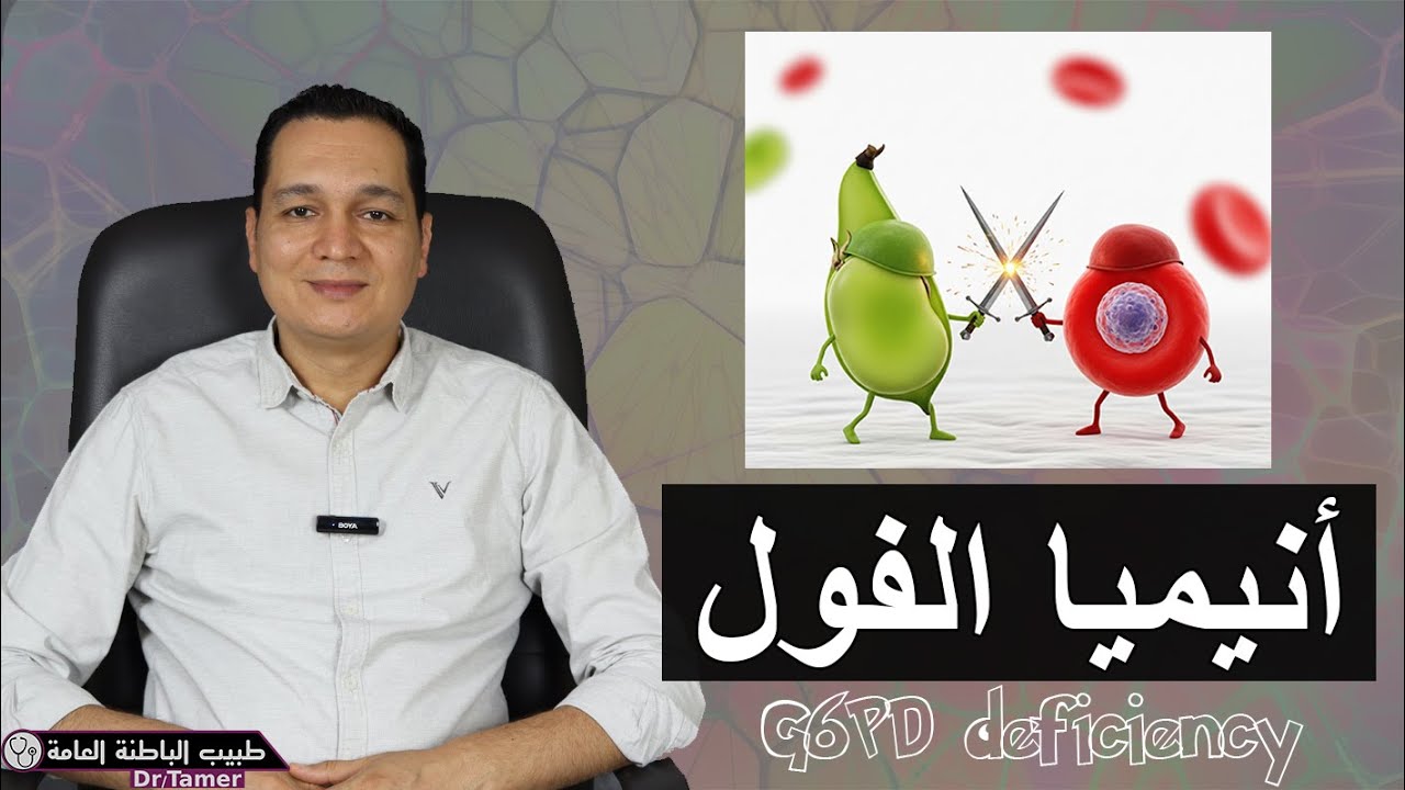 أنيميا الفول / G6PD deficiency
