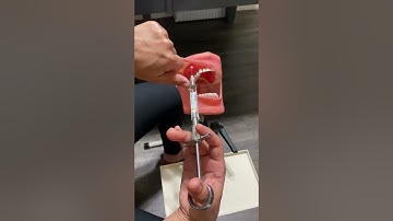 MSA injection on Typodont