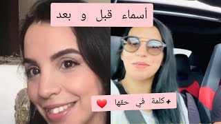 أسماء بيوتي قبل و بعد  كلمة في حق Asmaa beauty و كلمة في وجه منتقديها