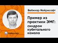 Пример из практики ЭМГ: синдром кубитального канала | Вебинар Нейрософт