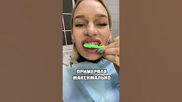 Tik-Tok: у меня такие крутые резинки на брекетах