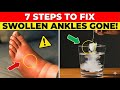 7 Steps to Fix Severe Ankle Swelling Before Bed (Step 7 Is What Doctors Use)