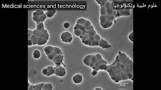 Cholera bacteria survives antibiotics by turning into globs تنجو الكوليرا من المضادات عن طريق التحول