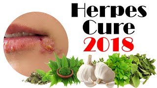 Herpes Cure 2018 Cure Herpes With Natural Products And Ayurveda