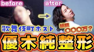 【整形事情】歌舞伎町ホスト優木純が整形してたって？？どこを？総額は？