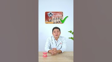 Nên chọn mắc cài thường hay mắc cài tự đóng