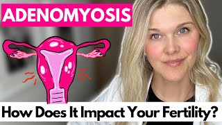 Adenomyosis: What are the Symptoms, Treatment, and Diagnosis? How Does It Impact Your Fertility?