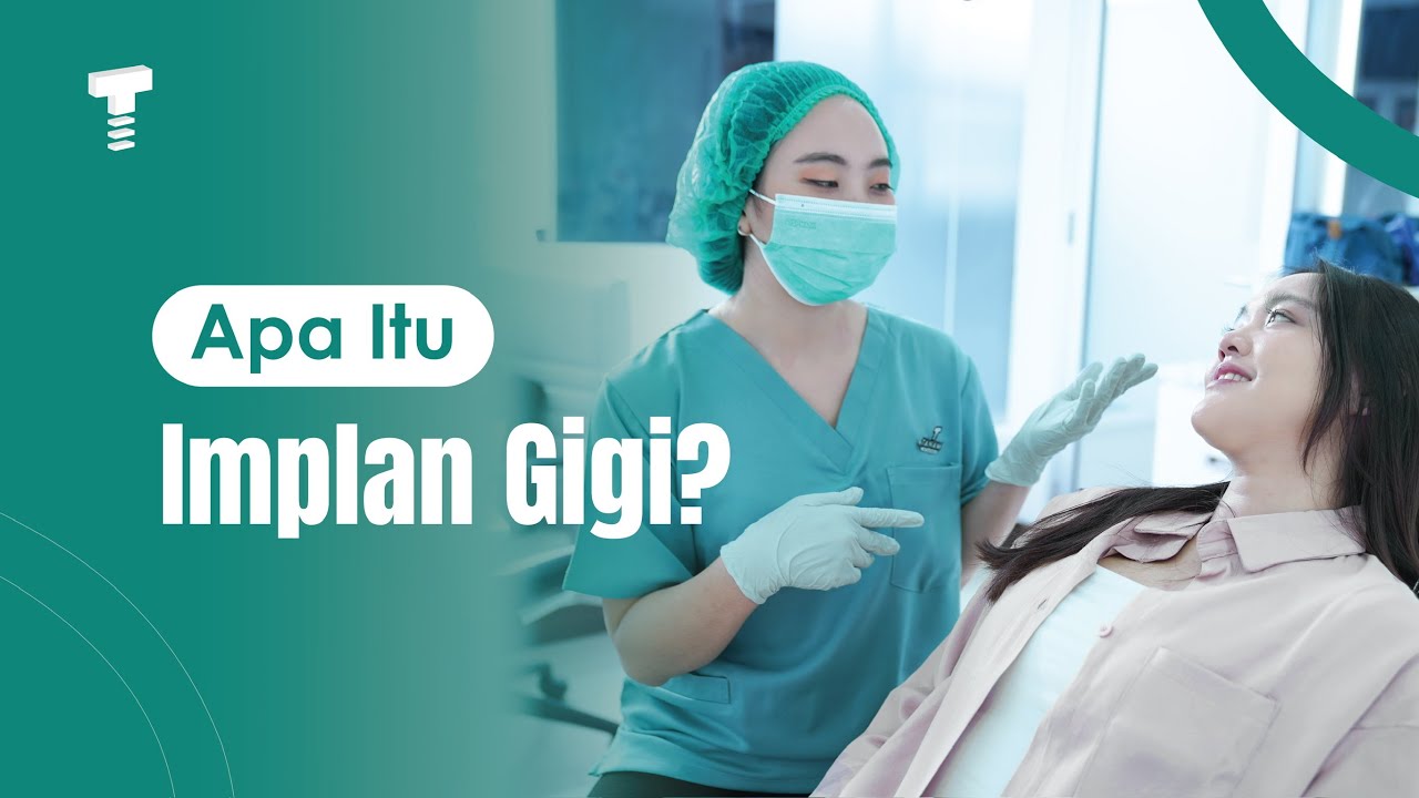 Mengenal Implan Gigi: Gigi Palsu Permanen yang Bisa Atasi Gigi Ompong