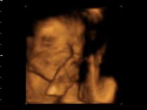 sean young 4d baby scan of jenny and sean