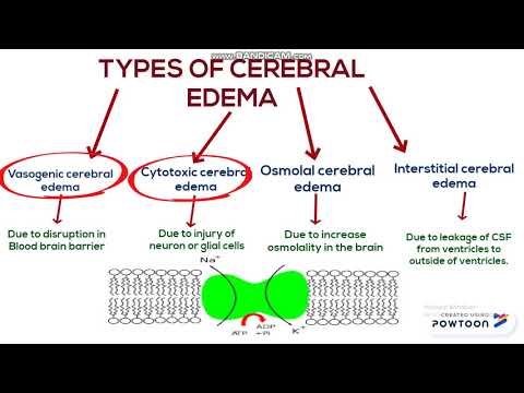 Video: Cerebral Edema: What Is It, Causes And Consequences