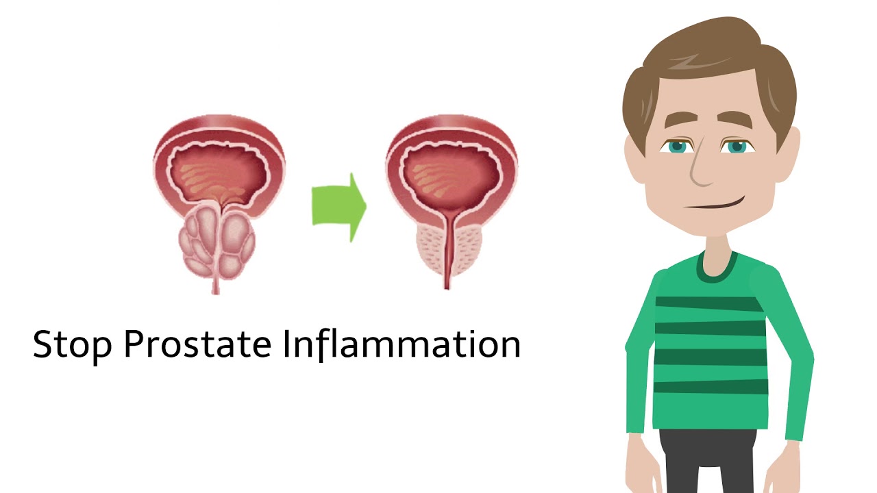 ActiPotens - Solve All Of Your Prostate Problems Today - YouTube