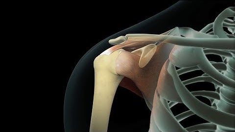 Rotator Cuff Shoulder Surgery