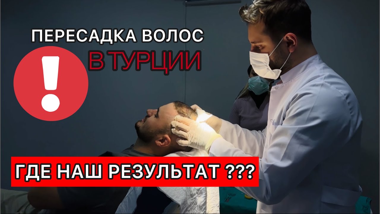 РЕЗУЛЬТАТ ПОСЛЕ ПЕРЕСАДКИ ВОЛОС .Уход после операции . ПЕРЕСАДКА ВОЛОС ...