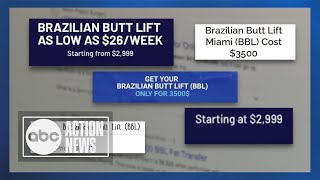 Brazilian Butt Lift deaths rose in Florida, even after rule changes