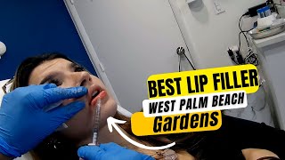 Can I massage my lip filler in West Palm Beach Gardens Discover the Secrets of Massaging Lip Filler