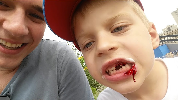 IZBILI SMO LUKI ZUB! Vlog dan 1 IGF