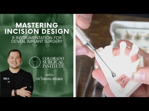 Mastering Incision Design Instrumentation for Dental Implant Surgery Avoid Common Mistakes