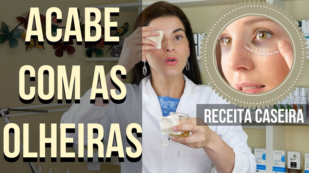 ACABE com as OLHEIRAS - Guia Completo Para Tratar em Casa