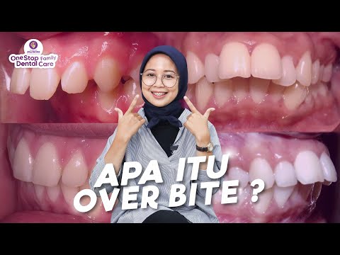 Video: Apakah yang menyebabkan gigi bengkok?