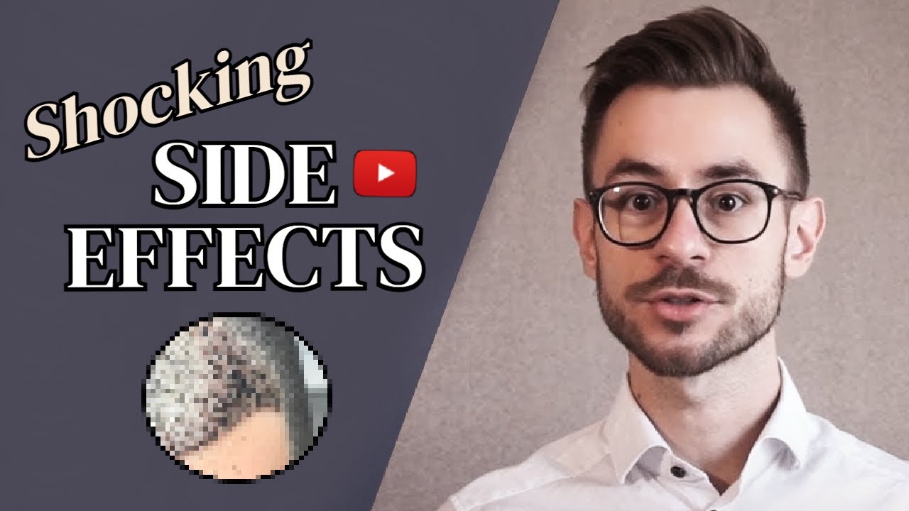 Hair Transplant Side Effects [5 MOST COMMON] YouTube