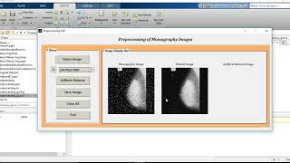 MATLAB code of Noise and Artifacts removal from Mammogram Images