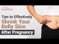 6 Tips to Tighten Loose Belly Skin After Pregnancy