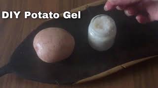 In 3 DAYS - I Removed DARK SPOTS, BLACK SPOTS, ACNE SCARS,  & Get a Glowing Skin using POTATO GEL