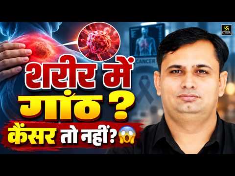 शरीर में गांठ? कहीं यह साइलेंट कैंसर तो नहीं? 😱 | Lipoma vs Cancer Symptoms | Bhagirath Sir