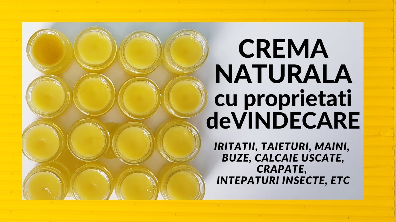 stadiul de pornire al varicozei